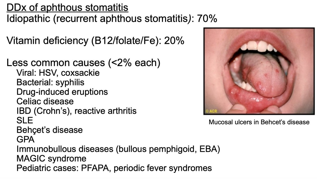 ACR21 Rheum Pearls and Secrets Not all (or most) ulcers is Behcet's! Here's  a great approach to use in clinic. Jason Kolfenbach: \, image size:1200x677