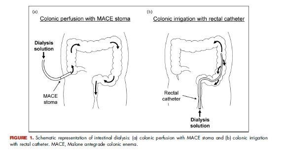 kamkalantar's tweet photo. Novel intestinal dialysis interventions and microbiome modulation to control uremia #CONH
Current Opinion in Nephrology and Hypertension https://t.co/kkNzv387SY
#IntestinalDialysis #Microbiome @lippincott https://t.co/YQ1HGA1bQg