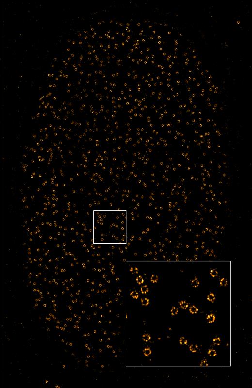 abbelight's tweet photo. And here is the image of @JonasRies NPC sample acquired yesterday evening on our #SAFe360. #nowwesee https://t.co/RUPDpBMl36