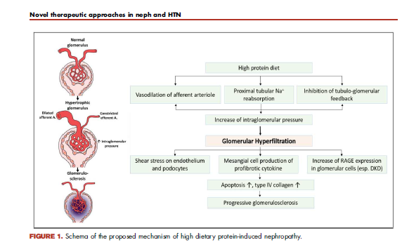 kamkalantar's tweet photo. Revisiting glomerular hyperfiltration and examining the concept of high dietary protein-related nephropathy in athletes and bodybuilders #CONH
#highDietaryProtein
#HighDietaryProteinNephropathy
Current Opinion in Nephrology and Hypertension https://t.co/17eKP1MfC3
@UCIkidney https://t.co/R3EtwSMpzE