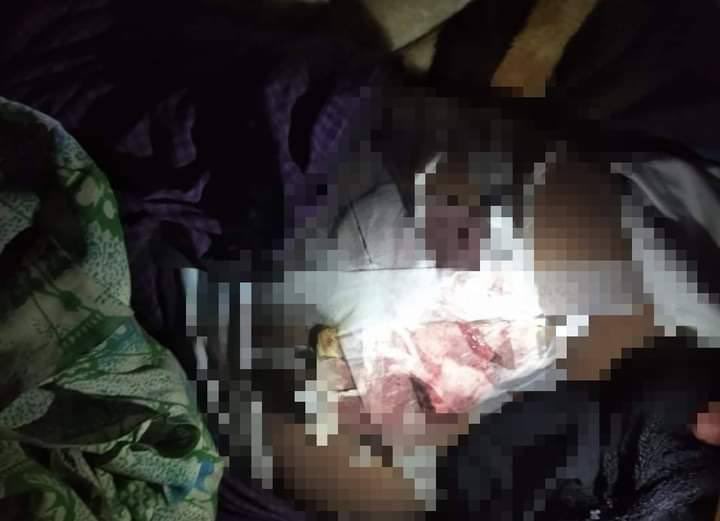 KhinAin's tweet photo. Tw // wound After clash broke out on Hakha-Dochi road on Nov6, SAC inspected and abducted the civilians on DoChi Road.They shot at a motorcycle with two men for turning back their cycle,a 50 yo man was shot and injured. #Nov7Coup   #WhatsHappeningInMyanmar https://t.co/qpUCS6x8OK
