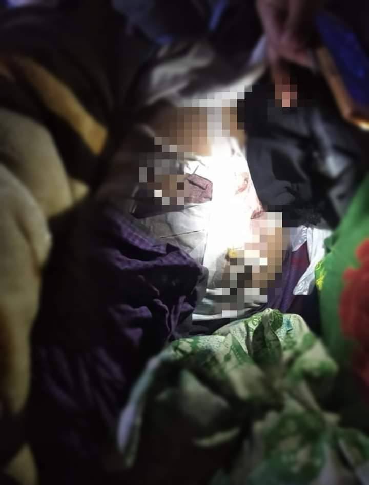 KhinAin's tweet photo. Tw // wound After clash broke out on Hakha-Dochi road on Nov6, SAC inspected and abducted the civilians on DoChi Road.They shot at a motorcycle with two men for turning back their cycle,a 50 yo man was shot and injured. #Nov7Coup   #WhatsHappeningInMyanmar https://t.co/qpUCS6x8OK