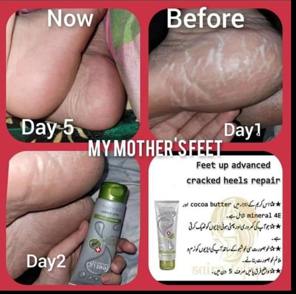 summandar01's tweet photo. Oriflame feet up cream review.
💯% Gauranteed results.
For order inbox, comment or mail summandar737@gmail.com.
#feetcream 
#feetcare 
#feetup 
#feet 
#feetheels 
#feetcareroutine 
#feettreatment . https://t.co/4N9MusnKAs