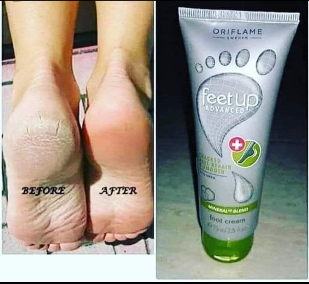 summandar01's tweet photo. Oriflame feet up cream review.
💯% Gauranteed results.
For order inbox, comment or mail summandar737@gmail.com.
#feetcream 
#feetcare 
#feetup 
#feet 
#feetheels 
#feetcareroutine 
#feettreatment . https://t.co/4N9MusnKAs