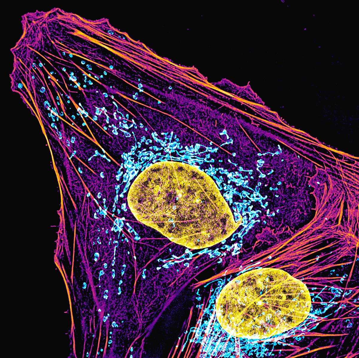 MAG2ART's tweet image. A cell photographed through a microscope. DNA (yellow), mitochondria (blue) and actin filaments (purple) are shown. Gamma correction on the actin filament channel was used to simultaneously display both the bright stress fibers and the dim cortex.
#CellBiology #SciArt #Biology
