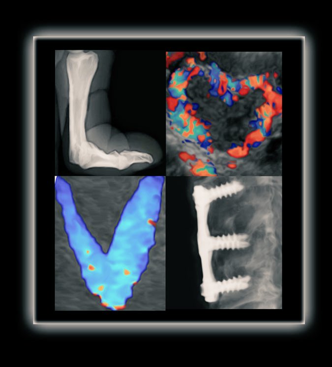 MRT Week is an annual celebration of the essential role that medical radiation technologists (MRTs) play in our healthcare system. To our Radiological, MRI, Nuclear Med &amp; Ultrasound MRTs across <a href="/UHN/">University Health Network</a> <a href="/SinaiHealth/">Sinai Health</a> <a href="/WCHospital/">Women's College Hospital</a>, we see you 👀 and thank you 🙏!!  Happy #mrtweek2021💙