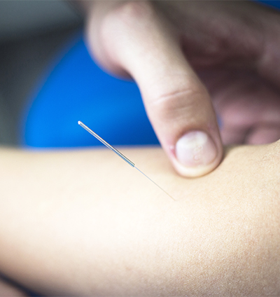 OPC_Health's tweet photo. November 2021 Dry Needling Courses - https://t.co/0MjudbXQAB https://t.co/WtQn7hF6w0