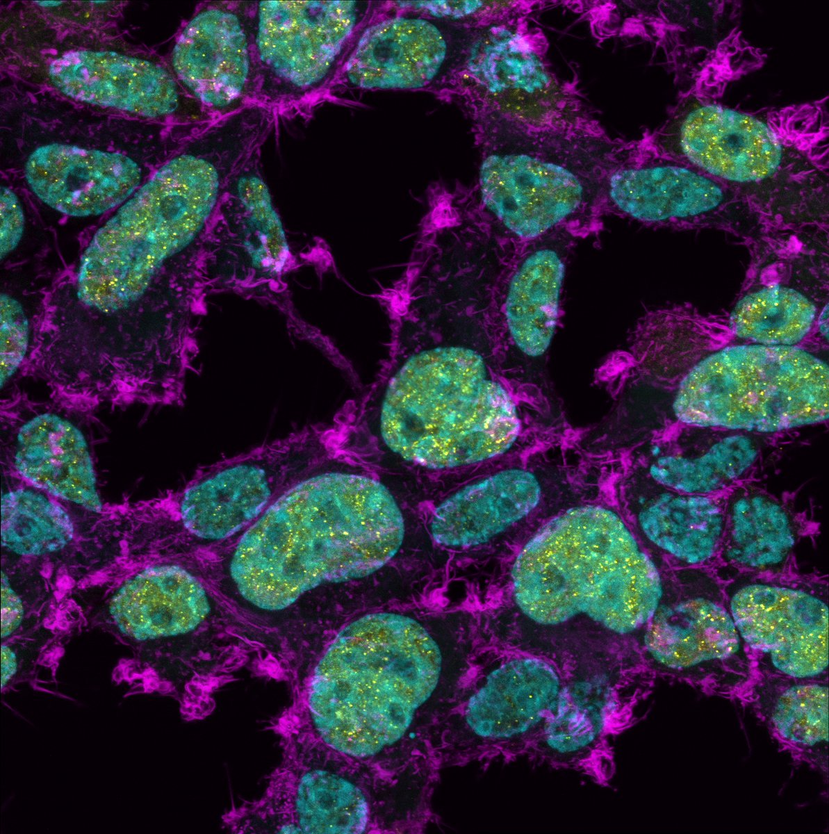 UOWFluorescence's tweet photo. Congratulations to all our MicroWorld Image and Motion Competition Winners! Stunning submissions captured by forefront Microscopy here @MolHorizons 2nd place Image winner Luke McAlary - 'Nuclear Speckles' https://t.co/eVz5qtBuwO