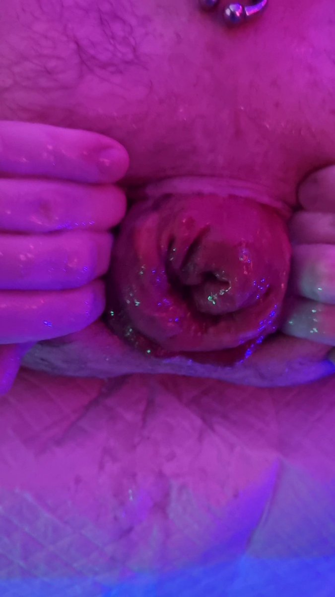 Let play a quick game. Guess the beaten butthole. After a weekend of #punchfisting #doublefisting and general anal battering. These are the results 3 very happy holes needing more. We like Absinthe and prosecco. #rosebud