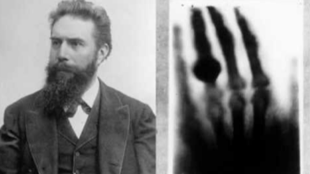 El 08/11/1895 Wilhelm Conrad Roentgen, mientras experimenta, se da cuenta de que por medio de un tipo de radiación es capaz de ver a través de materiales, incluyendo el cuerpo. Denomina este fenómeno "Rayos X", por la naturaleza desconocida de la radiación #DíaMundialRadiología