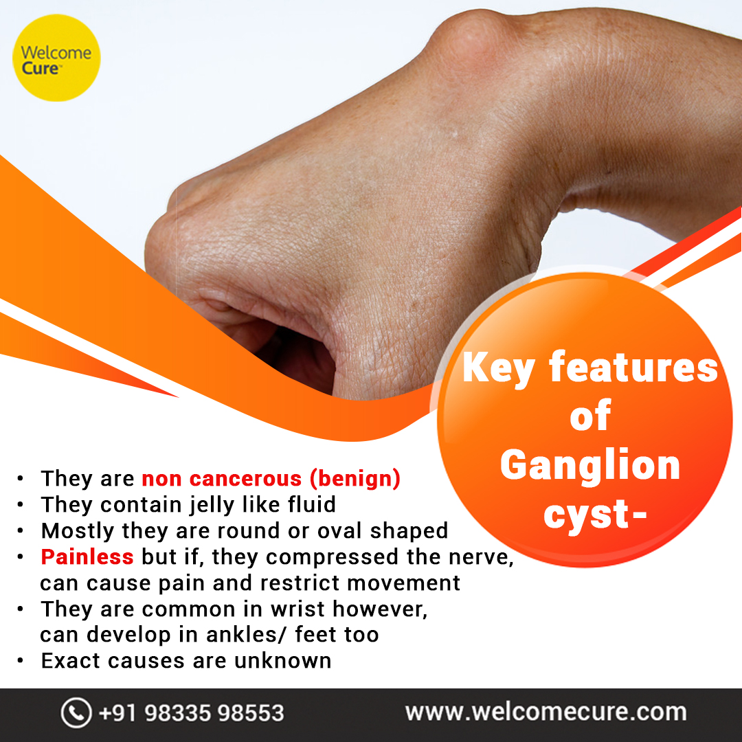 WelcomeCure's tweet photo. #KnowTheCondition
Ganglion cyst mostly appears along the tendons/ joints of wrists or hand and is benign in nature.
#Ganglioncyst #welcomecure #Ganglion #homeopathy #homeopathytreatment #health https://t.co/iQvtuhqT57