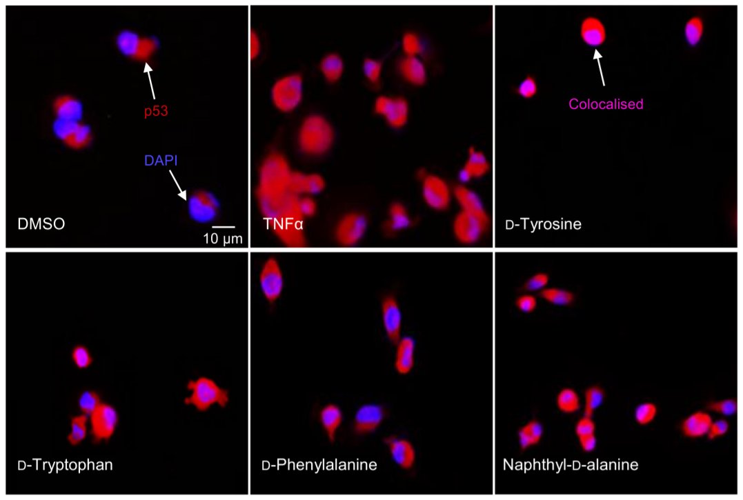 Landmark_IMR's tweet photo. Welcome to read the New Publication in Frontiers in Bioscience-Landmark:
Synthesis and analysis of small molecules to restrain the function of tissue factor within tumour cells, by Camille Ettelaie @UniOfHull
https://t.co/RJAVMLfVJA
#Tissue_factor #Pin1 #Cancer_cell #p53 #Bax https://t.co/UFGZ4hVtHG