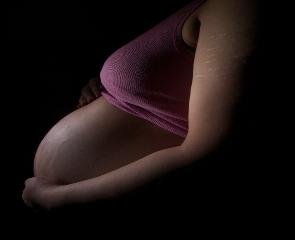 speciallymeco's tweet photo. What are stretch marks? What You Need to Know and How to Prevent Them. Read our blog post.

https://t.co/8C6liqYJxT https://t.co/ARzwkbuKxU