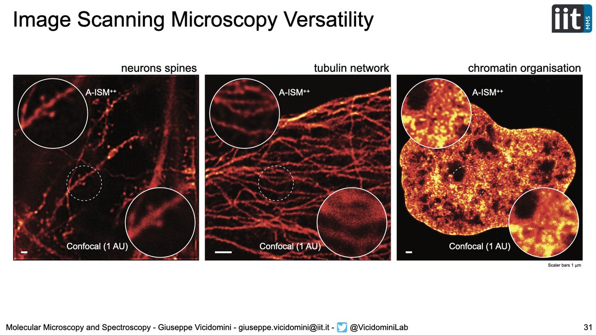 VicidominiLab's tweet image. Today, we will be @ICONorganizers. A general overview about our activities @IITalk  on #SPAD array for #superresolution #microsocpy, and new results from @GTortarolo on #STED #microscopy. Registration is free! icon-europe.org/register
#BrightEyes_ERC #singlephotonmicroscopy