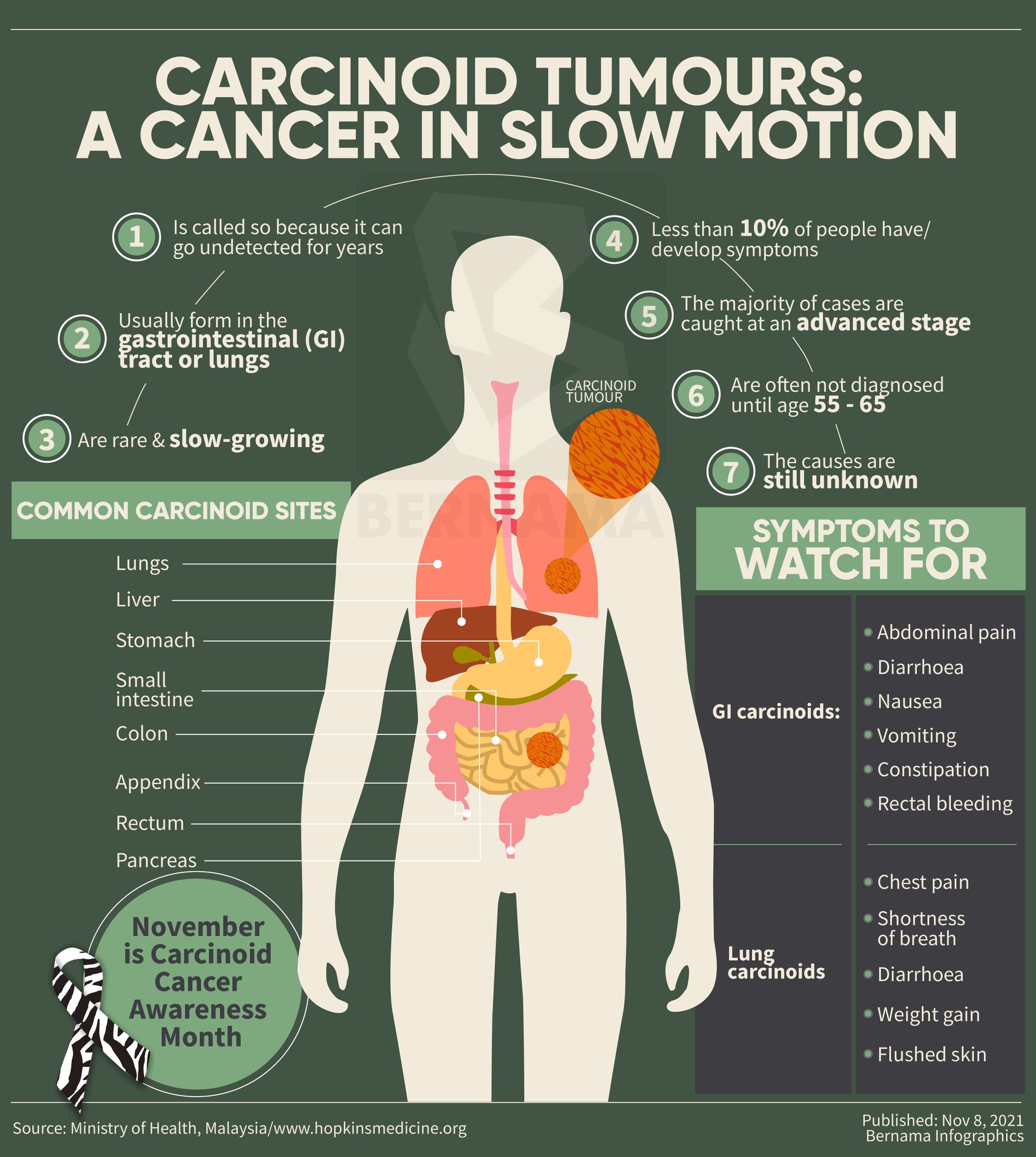 Bernama On Twitter 📌 Tumor Karsinoid Kanser Bergerak Perlahan 📌 Carcinoid Tumours A Cancer