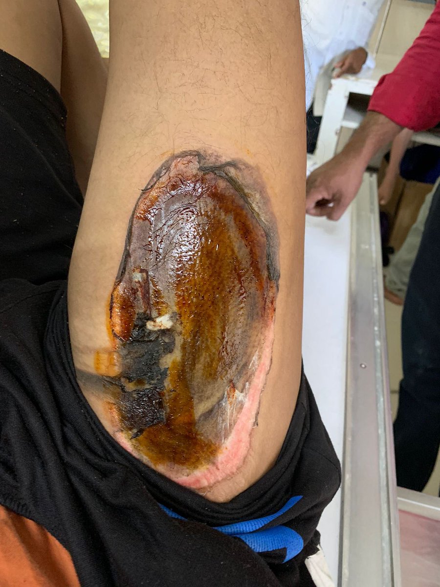 Ak1461's tweet image. One plus Nord user danger one plus blast again #oneplusnord2 #OnePlusblast