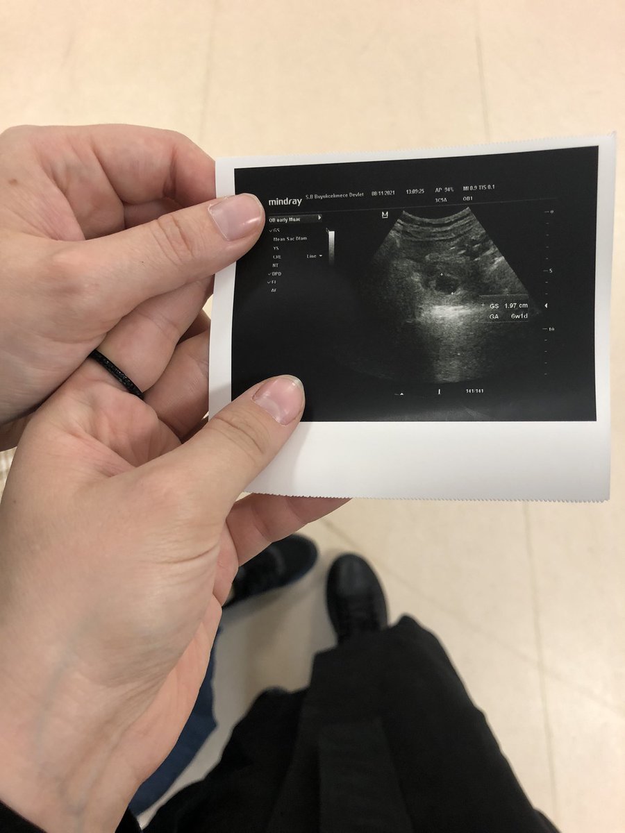 Teyze oldum ❤️<a href="/semrademirdnz/">Semra Demir❤️</a>