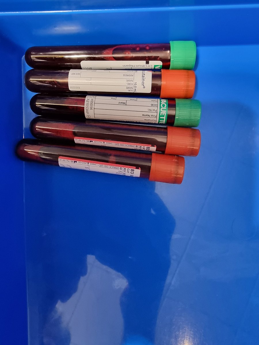 BreezerGalway's tweet photo. All done. Final bloods for the #ComCov2 trial.
Next stop Pfizer Booster innit! https://t.co/dySYdJhbN6