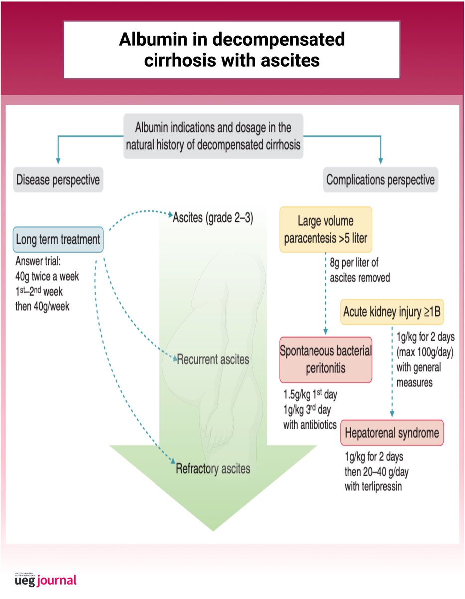 📌 Albumin: Indications in chronic liver disease

✅ ascites diagnosis &amp; types
✅ albumin indications &amp; dosage

Case with review: onlinelibrary.wiley.com/doi/10.1177/20…
#LiverTwitter #GITwitter <a href="/my_ueg/">my_UEG</a> <a href="/WileyHealth/">Wiley Clinical Health</a>