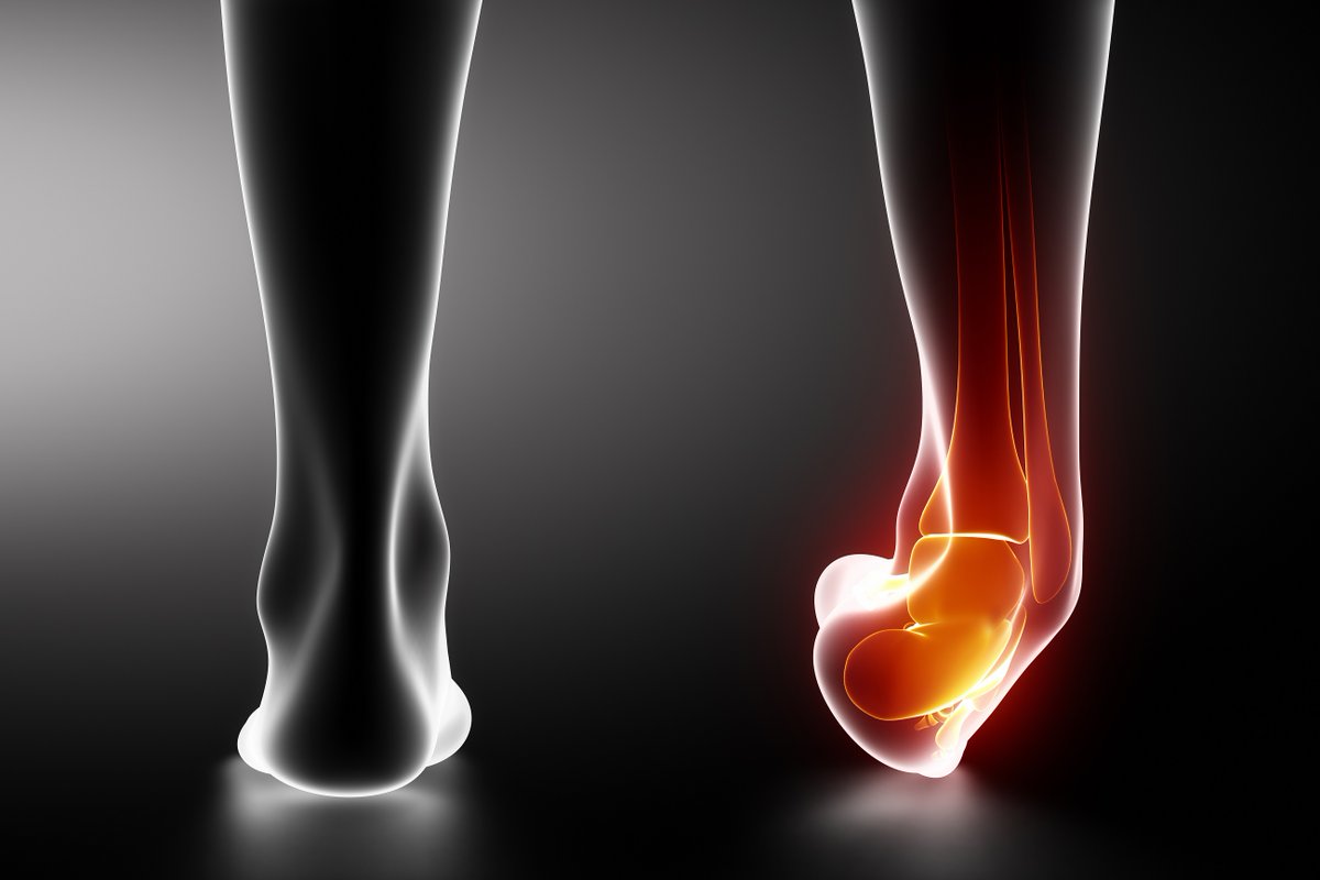 golding_pt's tweet photo. Your ankle is a complex assembly of nerves, tendons, ligaments, muscles, and bones. That is why Golding PT takes the utmost care of you!
 
Be sure to visit us or give us a call for more on how we can help! 🦶📲⬇️
https://t.co/Oz7IbljiOU
#GoldingPT #PhysicalTherapy #AnklePain https://t.co/fztPdk2Qez