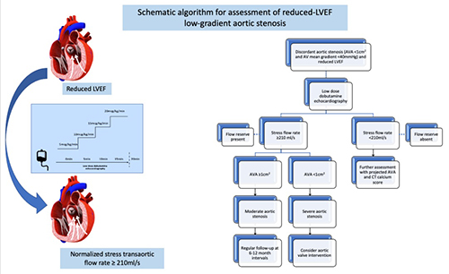 CircImaging (@circimaging) on Twitter photo Stress FR during LDDSE is useful for the detection of AS severity & flow reserve & is associated with outcomes following aortic valve intervention <a href="/AVamvakidou/">Anastasia Vamvakidou</a> <a href="/PPibarot/">Philippe Pibarot</a> <a href="/E_Guzzetti/">Ezequiel Guzzetti MD 🇦🇷🇨🇦</a> <a href="/pe_bartko/">Philipp E. Bartko</a> <a href="/orwi/">Stefan Orwat</a> <a href="/JoaoLCavalcante/">João Cavalcante</a> <a href="/BerglerKlein/">Jutta Bergler-Klein</a> <a href="/cshenoy3/">Chetan Shenoy</a> #AHAJournals ow.ly/cZZw50GIioZ Stress FR during LDDSE is useful for the detection of AS severity & flow reserve & is associated with outcomes following aortic valve intervention <a href="/AVamvakidou/">Anastasia Vamvakidou</a> <a href="/PPibarot/">Philippe Pibarot</a> <a href="/E_Guzzetti/">Ezequiel Guzzetti MD 🇦🇷🇨🇦</a> <a href="/pe_bartko/">Philipp E. Bartko</a> <a href="/orwi/">Stefan Orwat</a> <a href="/JoaoLCavalcante/">João Cavalcante</a> <a href="/BerglerKlein/">Jutta Bergler-Klein</a> <a href="/cshenoy3/">Chetan Shenoy</a> #AHAJournals ow.ly/cZZw50GIioZ