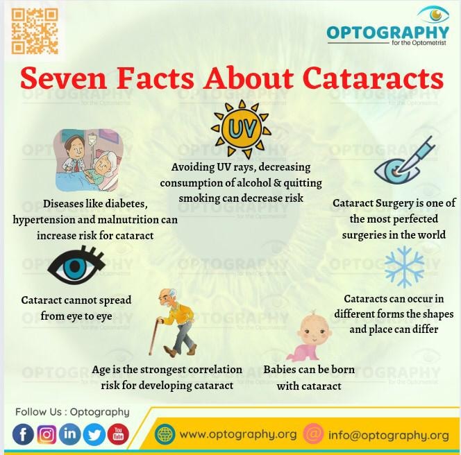 Optography8's tweet image. Most cataracts develop when aging or injury changes the tissue that makes up the eye's lens. Proteins and fibers in the lens begin to break down, causing vision to become hazy or cloudy.
#cataract #eyecare #optometry #Optography #dilseoptometrist #eyehealthcare #eyehealthtips