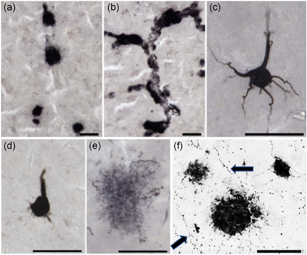 AmJournalPrimat's tweet photo. Comparative neuropathology in aging primates: a perspective. #aging #primates 
https://t.co/VidMKWNJDv https://t.co/tMuNraVWtS