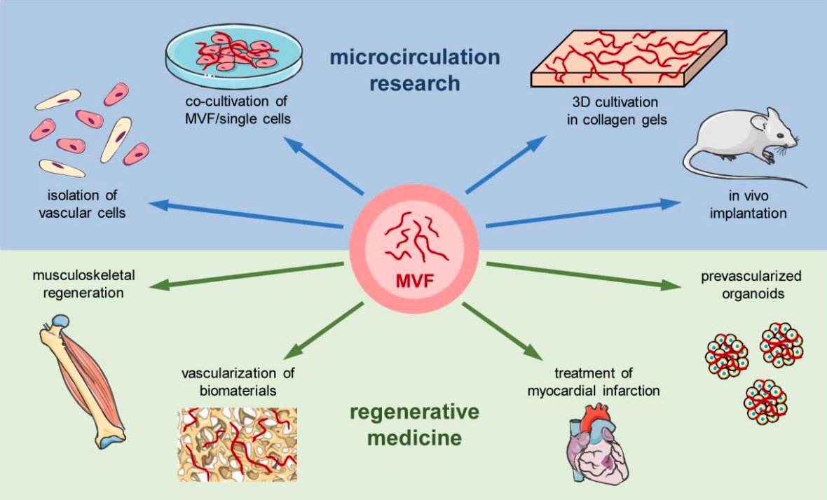 Raleigh M. Linville (@linvilleraleigh) on Twitter photo Microvascular fragments in microcirculation research and regenerative medicine | <a href="/TissueEngin/">Tissue Engineering</a>
#microvascular #bloodvessels #tissueengineering
liebertpub.com/doi/10.1089/te… Microvascular fragments in microcirculation research and regenerative medicine | <a href="/TissueEngin/">Tissue Engineering</a>
#microvascular #bloodvessels #tissueengineering
liebertpub.com/doi/10.1089/te…