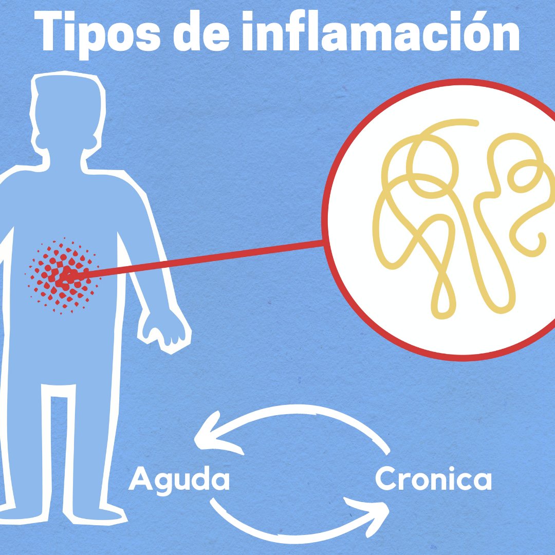 linki_DOC's tweet photo. La inflamación es una de las maneras en las que el cuerpo reacciona a una infección, lesión u otras afecciones médicas.
#inflamacion #lowgrateinflamation #inflamacionsilente #desinflámate #desinflamarse #bajarlainflamación #inflamacióncrónica #inflamaciónaguda https://t.co/KhoP3B1jO6
