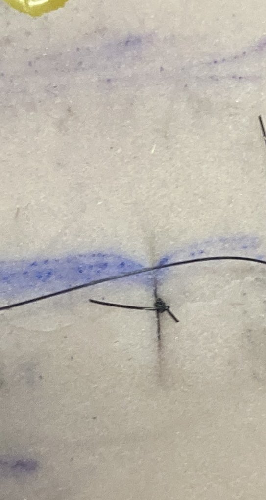 vinidavilla's tweet photo. Só pra mostrar aos meus filhos a minha primeira sutura. Foda-se se ela está bonitinha, bem feita ou não, mas foi minha primeira vez e a primeira vez sempre marca.
Quase chorei quando o professor falou:
“É isso ai Vinicius, continue nessa pegada”. https://t.co/siUblxNaXf