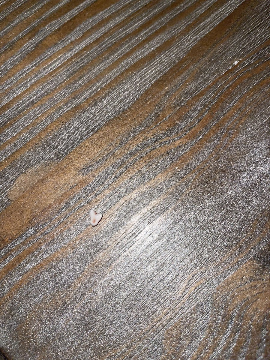 kenddiiee's tweet photo. @Jeffreyprice225 I mean, come on, look how cute this molar is https://t.co/rvRDRig6wt