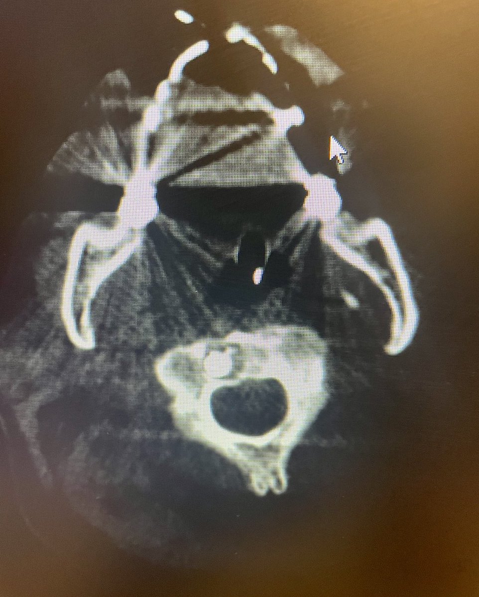 Ravi Srinivasa tweet media