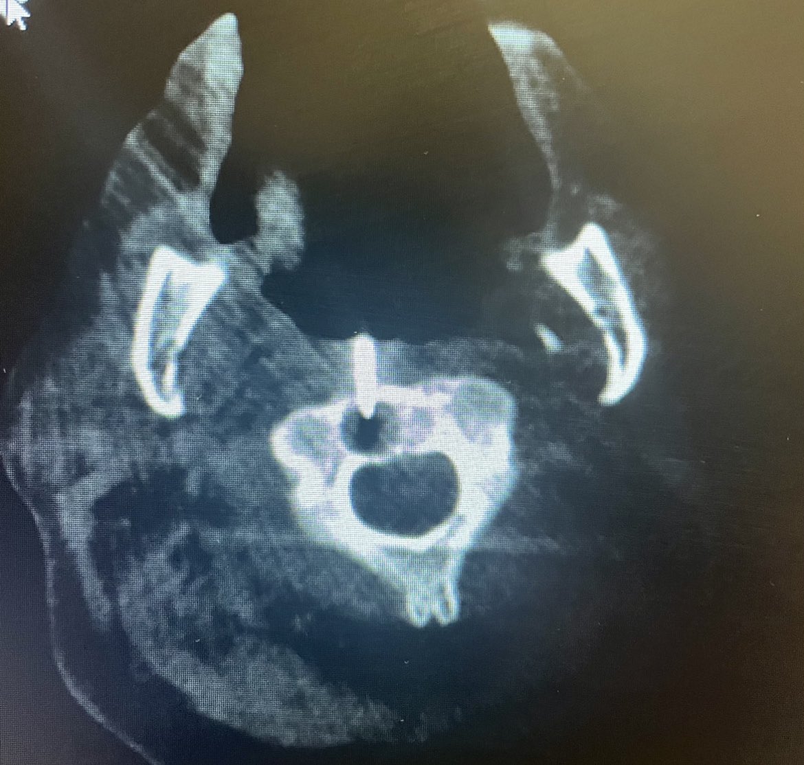 Ravi Srinivasa tweet media