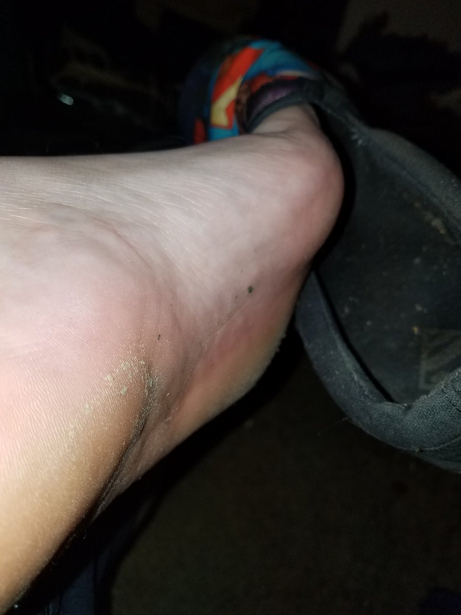 mistertoejam's tweet photo. Smell it!!! Inhale my stink!!! #footfetish #feetfetish #stinkyfeet #dirtyfeet #smellyfeet #guyfeet #manfeet #sweatyfeet #stinkyshoes #footsniffing #footstink #footworship #malefootfetish #sockless https://t.co/Z4sLZnHjLe