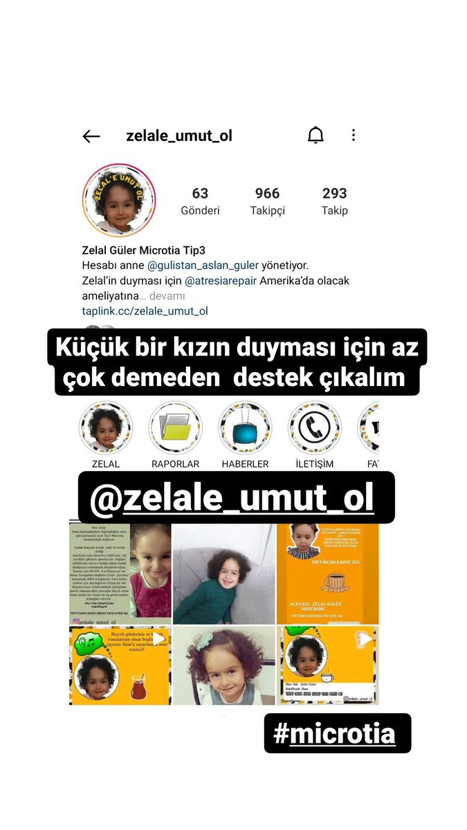Instagram sayfası küçük bir kızın duyması için destek çıkalım küçükler he mutlu olsun 
#microtia #kucukmelekler #2021KpssAtamaTakiplesiyor #SuesOEm #microtiatip3 #VirusCinese