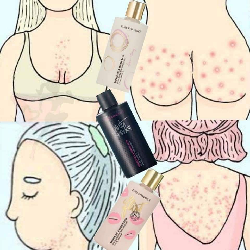 promancebynora's tweet photo. Shower gel que además de dajarte la piel suave e hidratada balancea tu pH corporal y ayuda a las ampollitas de la piel. 🥰 https://t.co/Era74MXaX3