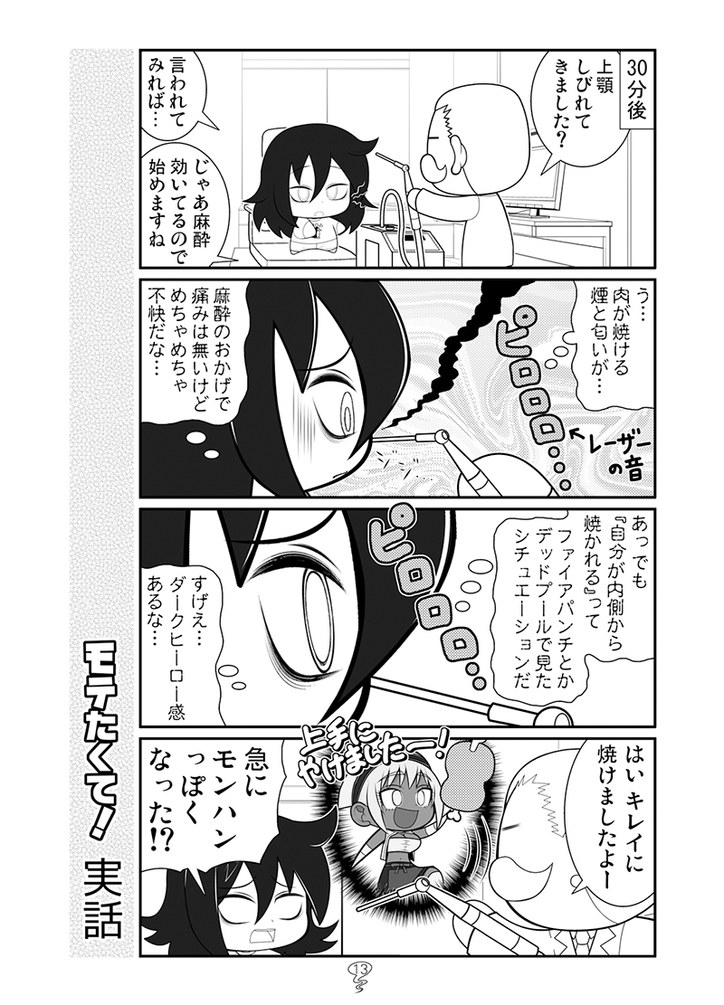 もこっちが鼻をレーザーで焼いた話
#わたモテ 