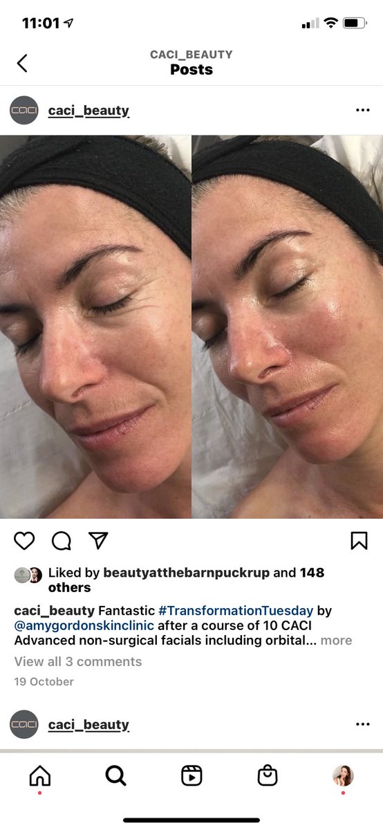 caciskintone's tweet photo. #CACI men and woman can’t get enough of these #firstclass facials. #investinyourself #lookgoodfeelgood https://t.co/Ya8XsHETCw