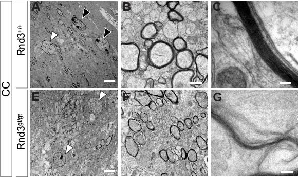📢New article in <a href="/BrainStrucFunc/">Brain Structure & Function</a> from <a href="/pilarmadrigal_/">Pilar</a>  <a href="/uchceu/">Universidad CEU UCH</a> about the role of Rnd3 in oligodendrocyte differentiation in collaboration with <a href="/NeuroAlc/">Instituto de Neurociencias UMH-CSIC</a> labs <a href="/LabSjurado/">SJurado_LAB</a>, <a href="/JAMoreno_Bravo/">Juan Antonio Moreno-Bravo</a> and <a href="/edepuelles/">Eduardo de Puelles</a>
➡️link.springer.com/article/10.100…
#Rnd3 #myelination #oligodendrocytes