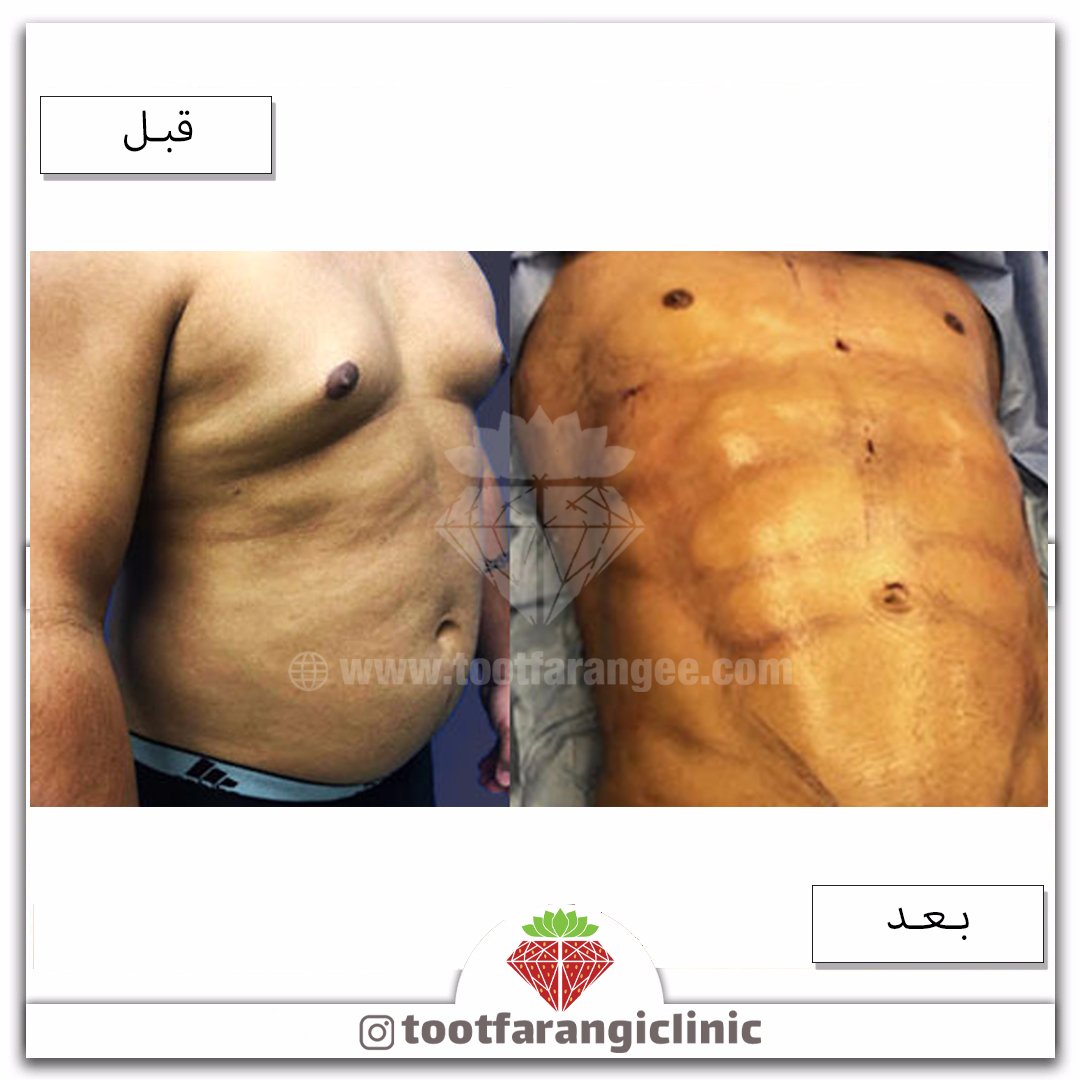 Tootclinic's tweet photo. طراحی سیکسپک و لاین اندازی🍓😻 https://t.co/W4x9Odgsgp