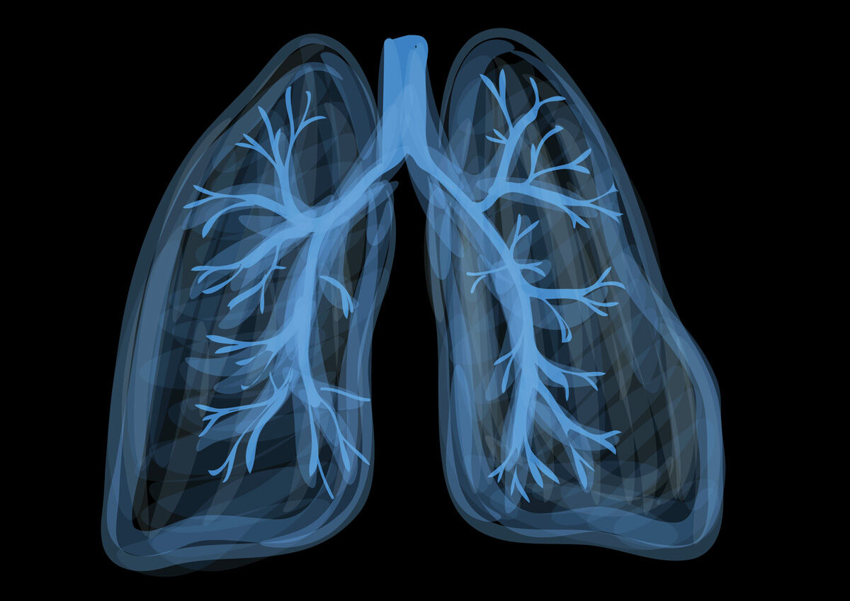HealingFlorida's tweet photo. Kick Butts with #Acupuncture 

cant #quit #smoking?  Understanding WHY you have an #addiction is the first step to true #healing. 

https://t.co/Y3WyC3f8ws

Why wait for the Great American #Smokeout? 

Robert Lutz (631) 232-7978
#Huntington #alternatives, #LargeIntestine https://t.co/8IWcKsZOdV
