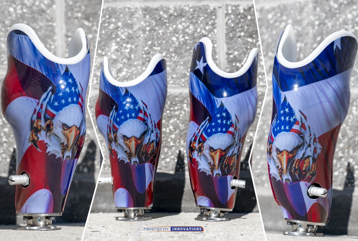 Bilateral BK Sockets ready for delivery! 🇺🇲🇺🇲🇺🇲 Nothing better than some red, white and blue to kick off the week! 🙌🙌🙌

#prostheticinnovations #prosthetics #prostheticlegs  #bilateralamputee #bilateralbk #prosthesis #teampi #prostheticsolutions #prolimb #believeachieve