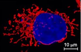 Crosstalk between mitochondrial fission and fusion machineries: #mitochondria-shaping proteins are generally considered to be binary components of either the fission or fusion machinery, but New Research suggests MIEF1/2 are regulators of both 

bit.ly/3D0rkFL