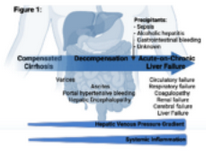 LTxJournal's tweet photo. Implications &amp; management of #cirrhosis-associated immune dysfunction pre- &amp; post-LTx by @ThomasTranah @DebbieShawcros1 et al

The authors summarize the detailed dynamic immunological perturbations associated w/advanced chronic liver disease
https://t.co/LiSfsWK4qs

#livertwitter https://t.co/aOdnKgvpDf