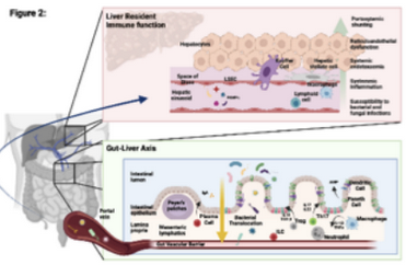 Liver Transplantation Journal (LTxJournal) (@ltxjournal) on Twitter photo Implications & management of #cirrhosis-associated immune dysfunction pre- & post-LTx by <a href="/ThomasTranah/">Thomas Tranah</a> <a href="/DebbieShawcros1/">Debbie Shawcross</a> et al
The authors summarize the detailed dynamic immunological perturbations associated w/advanced chronic liver disease
aasldpubs.onlinelibrary.wiley.com/doi/10.1002/lt…
#livertwitter Implications & management of #cirrhosis-associated immune dysfunction pre- & post-LTx by <a href="/ThomasTranah/">Thomas Tranah</a> <a href="/DebbieShawcros1/">Debbie Shawcross</a> et al
The authors summarize the detailed dynamic immunological perturbations associated w/advanced chronic liver disease
aasldpubs.onlinelibrary.wiley.com/doi/10.1002/lt…
#livertwitter