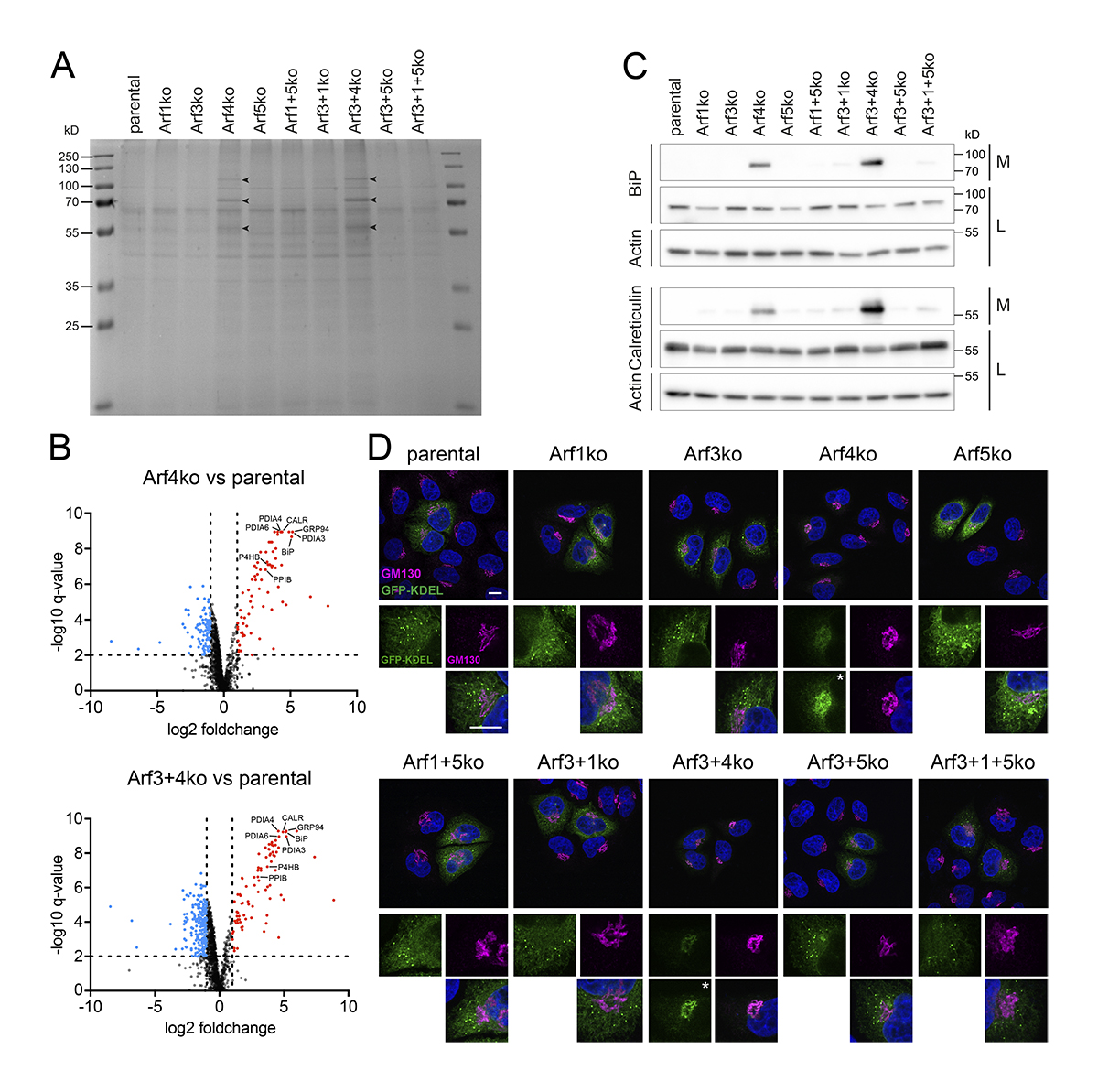 JCellBiol's tweet photo. The small #GTPases Arf1-5 are important regulators of membrane traffic and #Golgi functions. Pennauer, Spiess et al. @biozentrum analyze viability and phenotypes of individual and combined CRISPR/Cas9 Arf knockout cell lines. https://t.co/0ZMBfR5zj2
#Trafficking #organelles https://t.co/TmYkWNFkSG