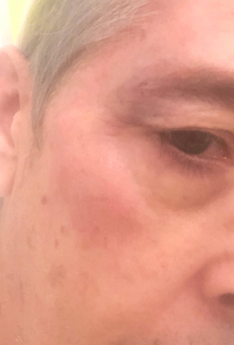 El  quería una baja y sino te rompo la cara  y vaya si lo hizo #Primaria 
¿Que mas hay que poner?                     👉🏻 Retuitea