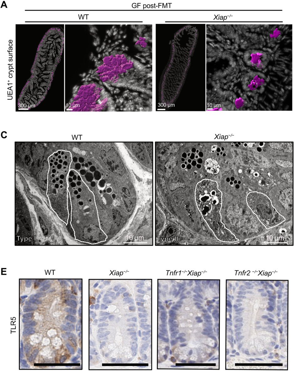 SciImmunology's tweet photo. Two new studies in mice show how #XIAP protein deficiency leads to #IBD inflammation, with antimicrobial #peptides as possible therapy.
Read more ⬇
https://t.co/LXTXIzggxR
https://t.co/328pWMR7nr https://t.co/xT4UaiLsPr