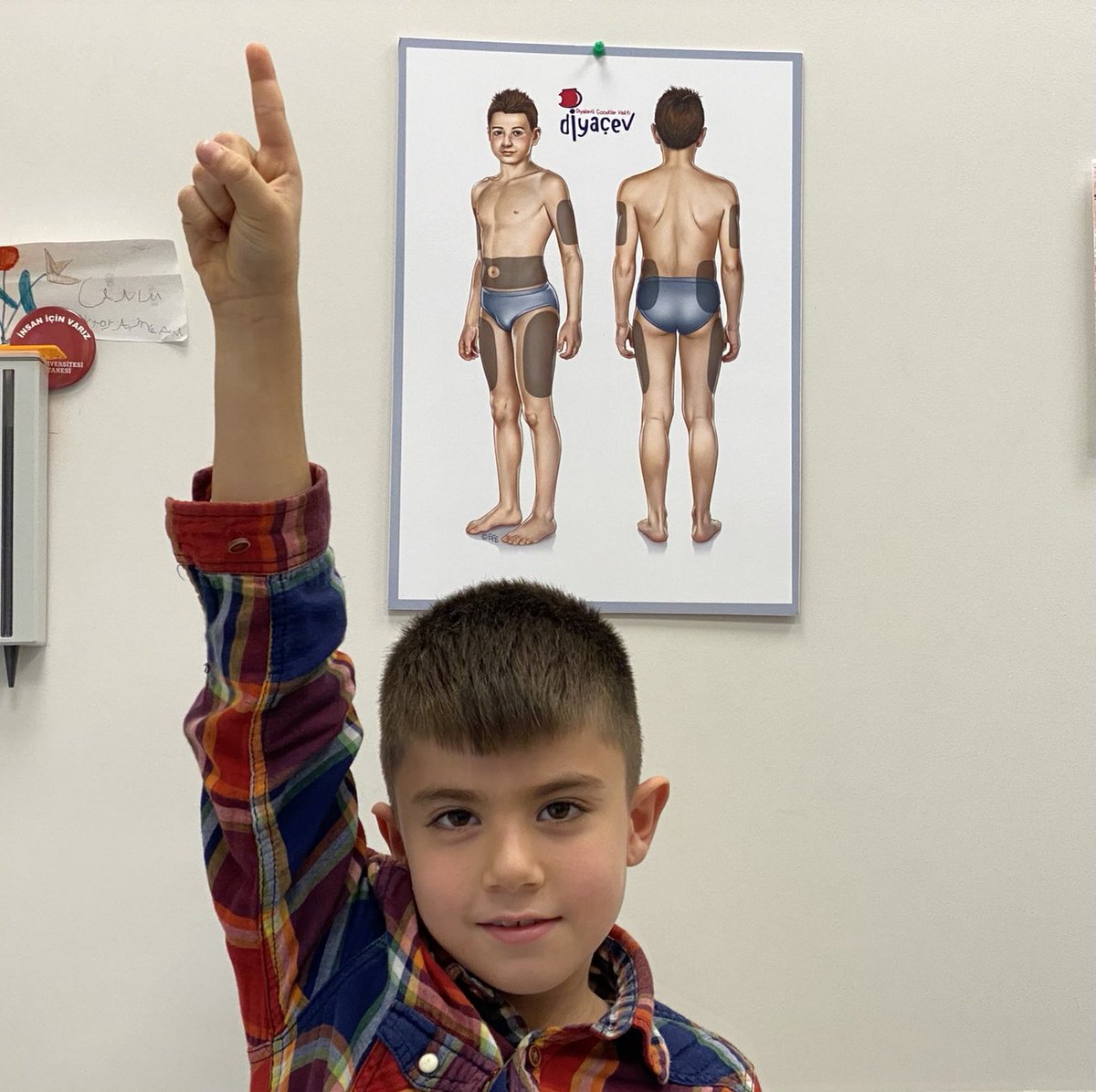 Yahya Ali Çelik. 8 yaşında. Emekçi bir ailenin çocuğu. Öğlen okulda yemek yiyor ve kan şekerini kendisi ölçüyor. Her gün öğretmeni annesini arıyor ve sonuca göre insülin yapıyorlar. Güçleri sensör almaya yetmiyor. “Sensör için parmak kaldır” ın anlamı bu. ⁦<a href="/sgksosyalmedya/">SGK</a>⁩