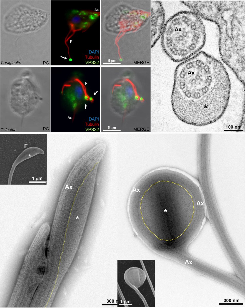 Our paper about a novel extra-axonemal structure in Trichomomas vaginalis and Tritrichomonas foetus is out in Frontiers frontiersin.org/article/10.338…
Special thanks to <a href="/veronicacocere1/">奔驰体育|时时彩|极速百家乐|四亿彩票|KOK招商</a> and <a href="/deMiguelN/">Natalia de Miguel 👩🏻‍🔬</a> for all support and work